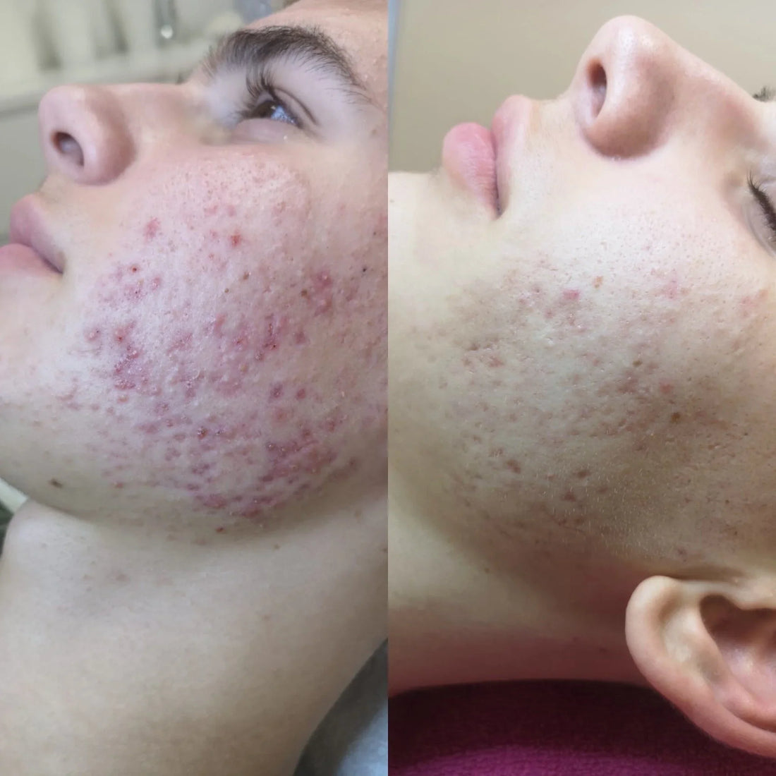 A Peel Suitable for All Seasons