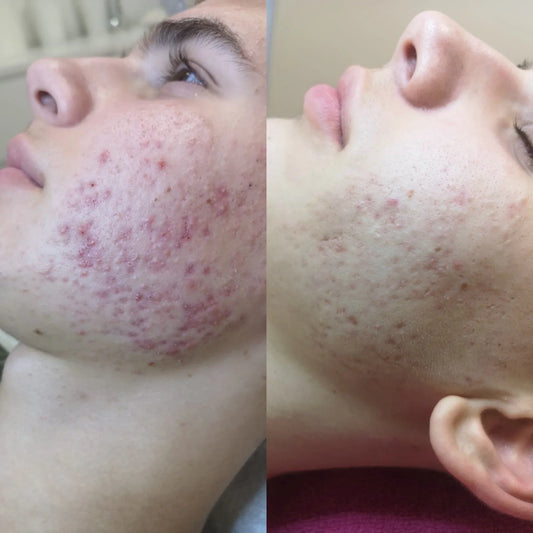 A Peel Suitable for All Seasons