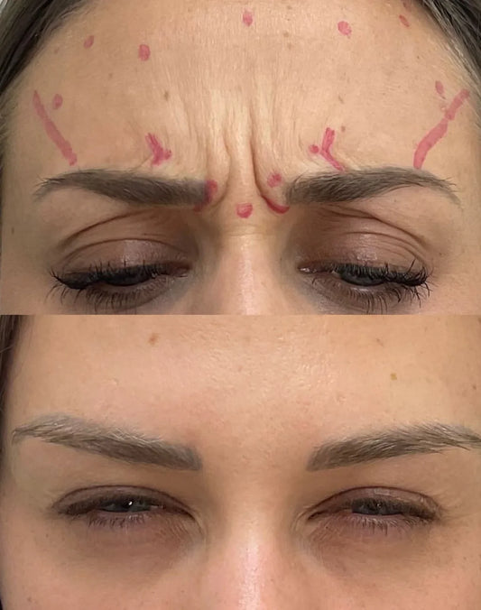 Wrinkle Relaxers