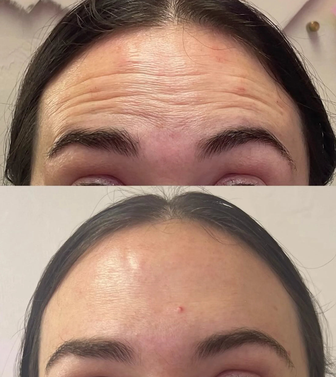 How much wrinkle relaxer will I need?