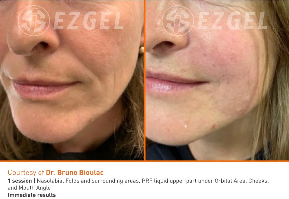 Bio-filler