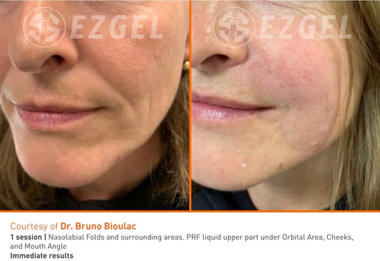 Bio-filler